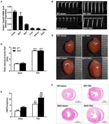 Seipin Deficiency Accelerates Heart Failure Due to Calcium Handling Abnormalities and Endoplasmic Reticulum Stress in Mice